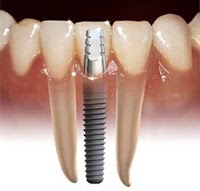 1st Choice Dentures 147089 Image 8