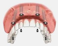 Complete Dental Care 150388 Image 7