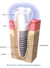 Cosmetic Dentist and Dental Implants Norwich   Dr Ori Michaeli 138006 Image 5