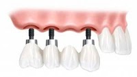 Cosmetic Dentist and Dental Implants Norwich   Dr Ori Michaeli 138006 Image 6