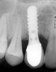 Cosmetic Dentist and Dental Implants Norwich   Dr Ori Michaeli 138006 Image 8