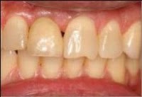Dental Implants Yorkshire 150483 Image 1