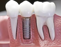 Ghauri Dental Centre 141538 Image 0