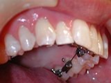 Herts Orthodontics 152083 Image 3