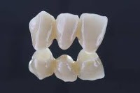 Mid Ulster Dental Ceramics 155535 Image 4