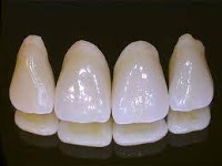 Mid Ulster Dental Ceramics 155535 Image 6