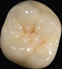Mid Ulster Dental Ceramics 155535 Image 8
