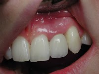 Oralimplants Ltd 150772 Image 0