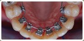 Oraprime Orthodontics 155214 Image 1