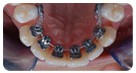 Oraprime Orthodontics 155214 Image 6