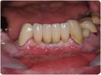 Regent Dental Laboratories Ltd 151656 Image 0