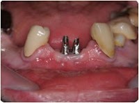 Regent Dental Laboratories Ltd 151656 Image 1