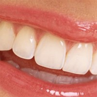 Stoneyfields Dental Practice 155403 Image 0