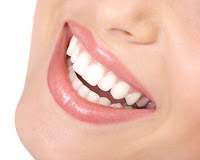Teeth Whitening Kits 145390 Image 0