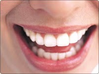 Teeth Whitening London 150594 Image 1