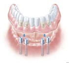 Clifton Dental Clinic 152579 Image 3