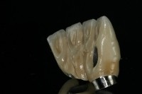 D S Dental Laboratory 139796 Image 2