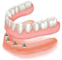 Dental Health Care 153776 Image 4