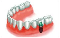 Dental Health Care 153776 Image 6