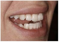 Dental Health Care 153776 Image 8