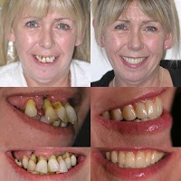 Dr Raj Ahlowalia. Smile makeovers, veneers and teeth whitening, Biggleswade, Beds 144852 Image 1
