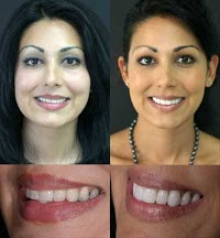 Dr Raj Ahlowalia. Smile makeovers, veneers and teeth whitening, Biggleswade, Beds 144852 Image 5