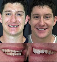 Dr Raj Ahlowalia. Smile makeovers, veneers and teeth whitening, Biggleswade, Beds 144852 Image 9