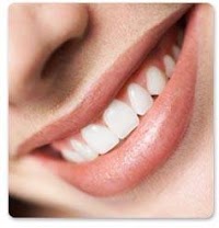 HD Teeth Whitening 153026 Image 0