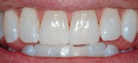 Just Smile Dental Practice 151892 Image 2