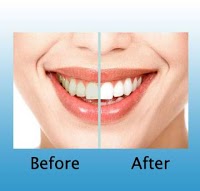Leeds teeth whitening cosmetic dentist dental specialist invisalign braces 141349 Image 1
