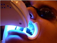 Leeds teeth whitening cosmetic dentist dental specialist invisalign braces 141349 Image 9