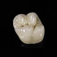Mid Ulster Dental Ceramics 155535 Image 1