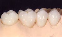 Mid Ulster Dental Ceramics 155535 Image 2