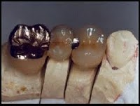 Mid Ulster Dental Ceramics 155535 Image 5