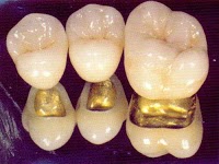 Mid Ulster Dental Ceramics 155535 Image 7