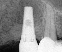 Peter Kertesz Dental Surgery 153057 Image 4
