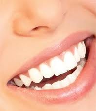 Polished Mobile Teeth Whitening 153837 Image 0
