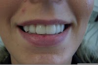 Smile Dental Care 138523 Image 4