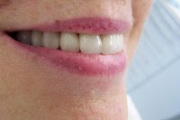 Smile Dental Care 138523 Image 9
