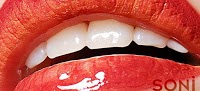 Soni Dental Implants 153680 Image 2