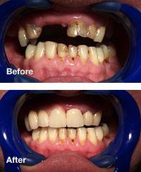 Spires Dental Clinic 154360 Image 4
