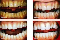Spires Dental Clinic 154360 Image 5