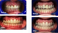 Spires Dental Clinic 154360 Image 6