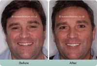 Sussex Braces   Orthodontist Dr Alastair Smith 147120 Image 1