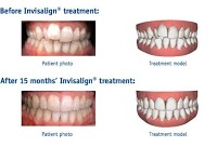 Sussex Braces   Orthodontist Dr Alastair Smith 147120 Image 4