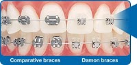 Sussex Braces   Orthodontist Dr Alastair Smith 147120 Image 5