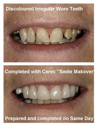 Tangmere Dental Care Ltd 137965 Image 8