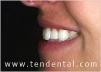 Ten The Pavement Dental Health 154371 Image 2