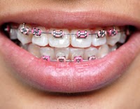 Vivadent dental clinic 152169 Image 7