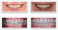 WeLCOMe Orthodontics 155266 Image 4